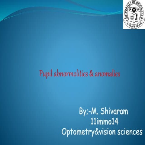Pupil anomalies and disorders shiva ppt