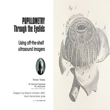 Pupillometry Through the Eyelids