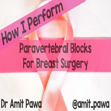 How I perform my Paravertebral Blocks for breast surgery
