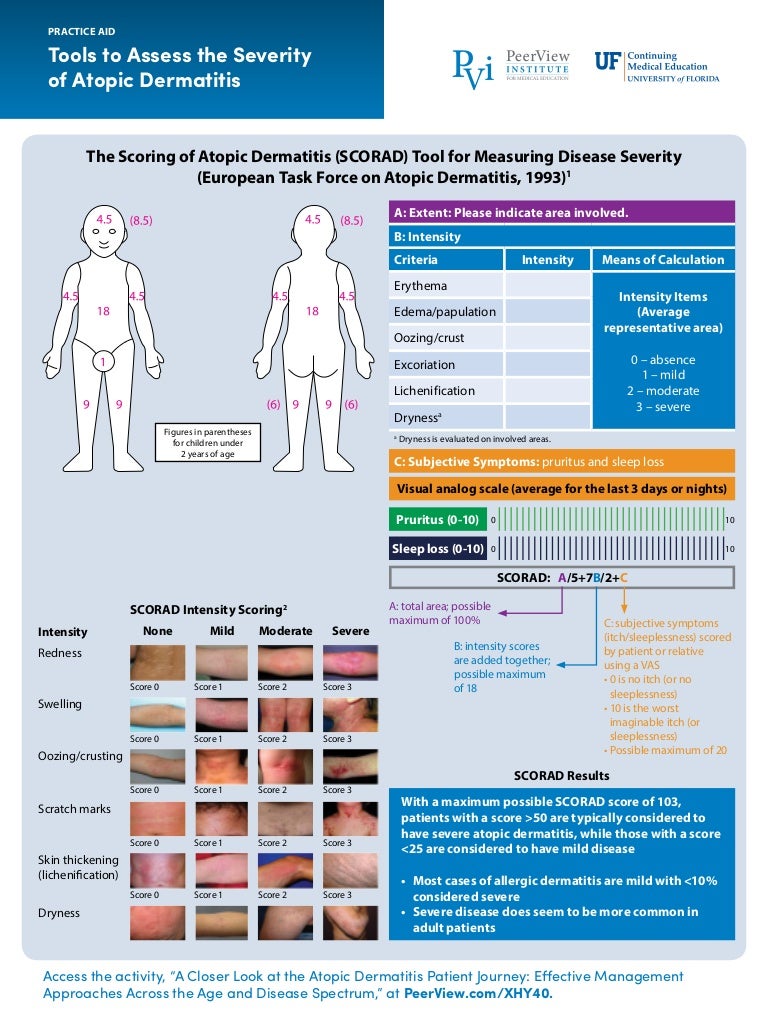 patient journey in atopic dermatitis the real world scenario