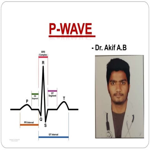 P wave (ECG) - Dr. Akif Baig