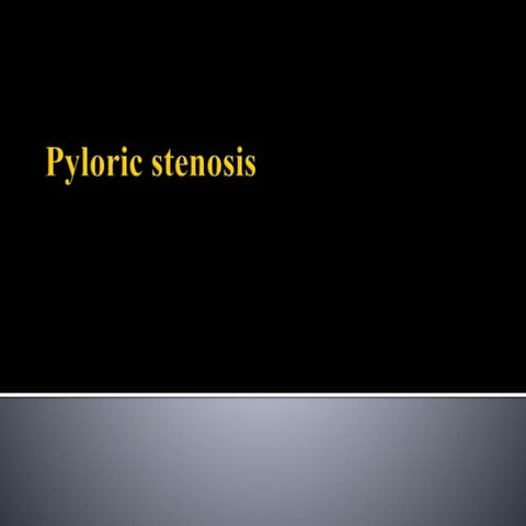 Pyloric stenosis notes
