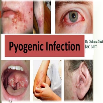 Comprehensive Overview of Pyogenic Infections: Causes, Diagnosis, and ...