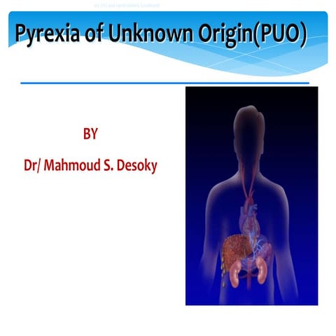 Pyrexia of unknown origin