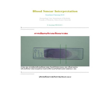 Peripheral blood smear