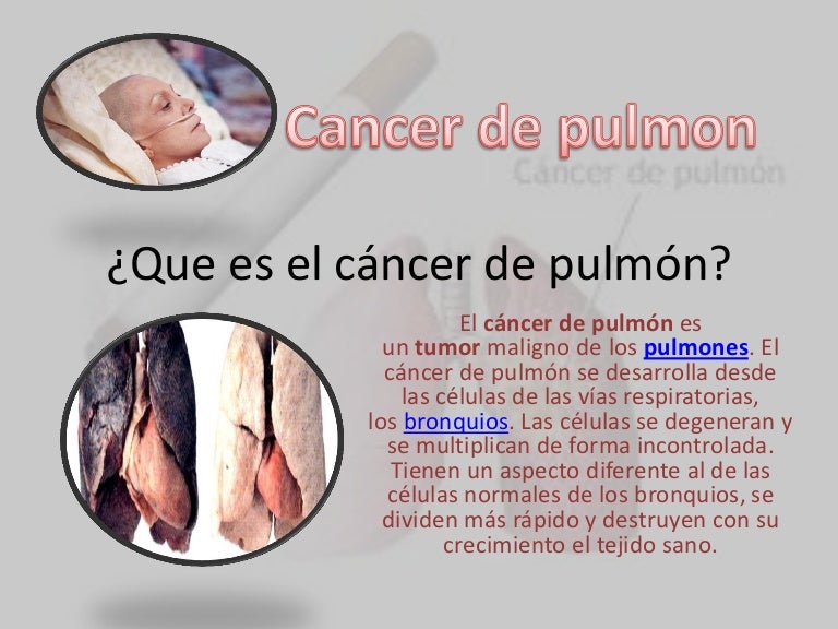 cancer maligno que es