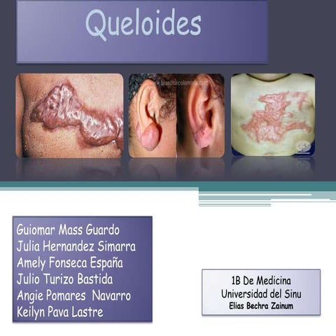 Queloides (1) (1) (1)