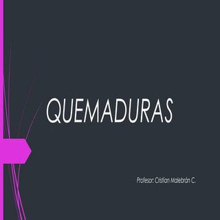Quemaduras