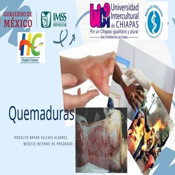 Quemaduras y manejo clinico en adultos.pptx