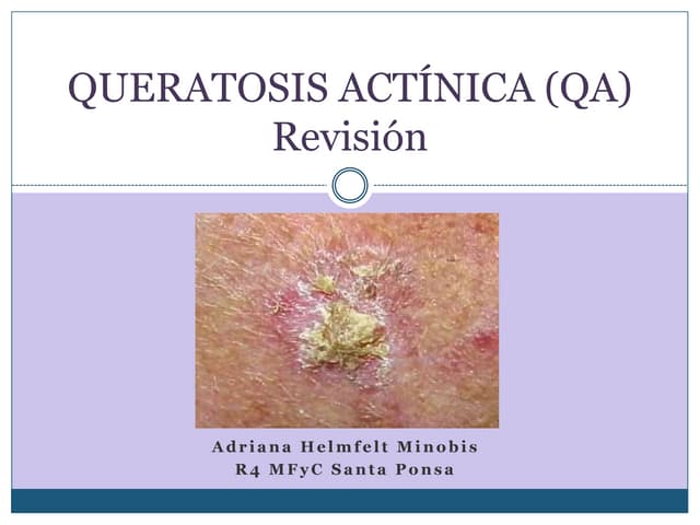 Queratosis actínica (qa)