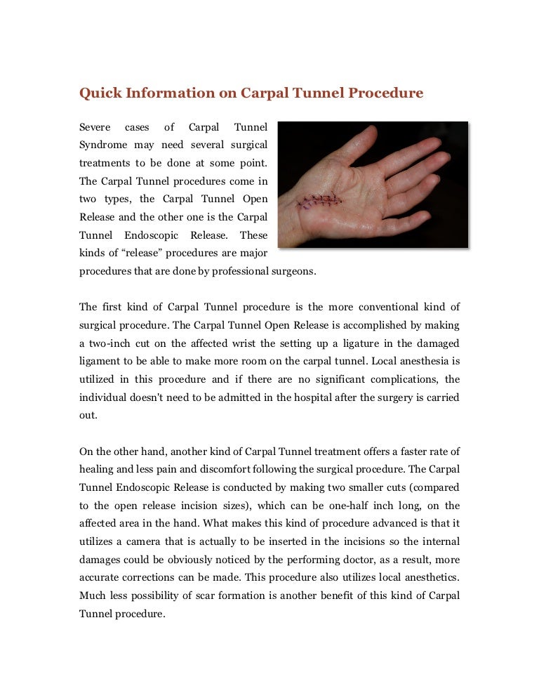 Quick Information on Carpal Tunnel Procedure
