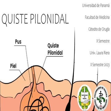 QUISTE PILONIDAL CIRUGÍA LAURA RIERA.pptx