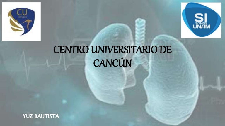 riñón con algunos quistes corticales metástasis de cáncer de próstata riñón con algunos quistes corticales metástasis de cáncer de próstata