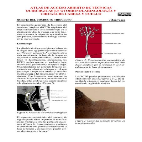 Quistes vestigiales y de epitelio mucoso | PPTX