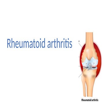 Comprehensive Diagnosis of Rheumatoid Arthritis: Clinical, Laboratory ...