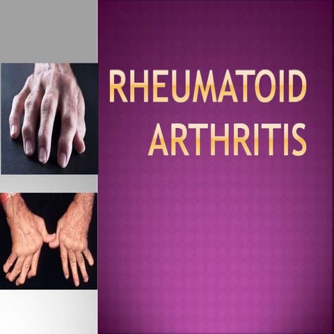 RA-rhemautoid athritis.pptx