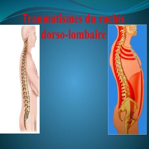 Technique radiologique rachis cervical | PPT