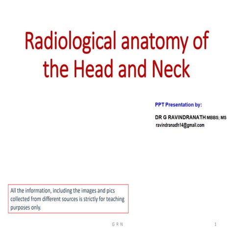 Radiological anatomy of the Head and Neck