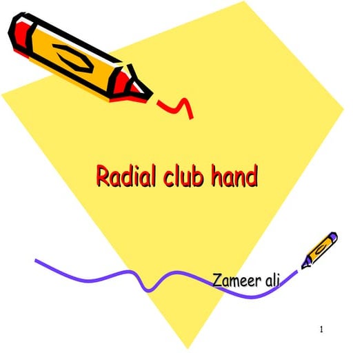 Radial club hand