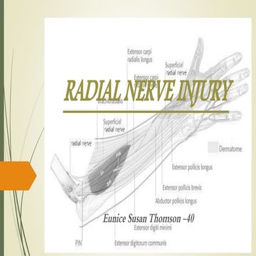 Radial nerve injury