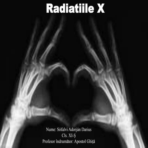 Radiatii X | ODP