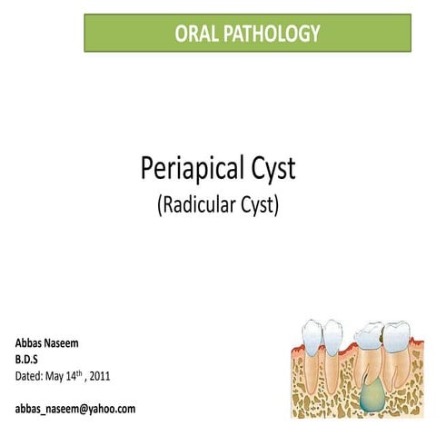Radicular cyst or Periapical cyst