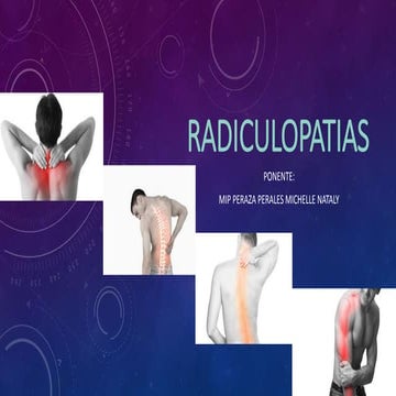 Radiculopatias 