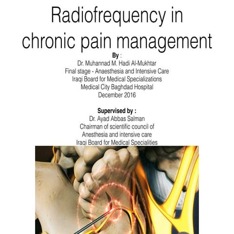 Radiofrequency in chronic pain management