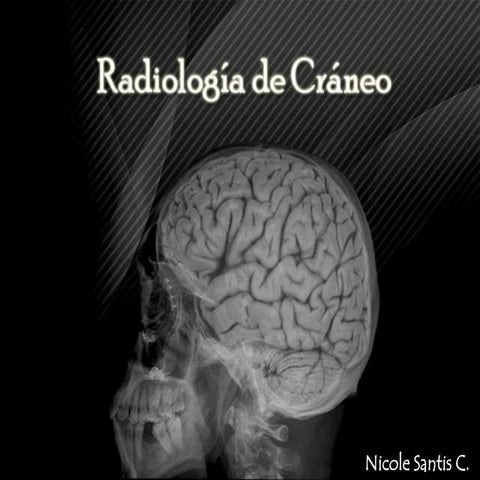 TECNICA DE VON ROSEN.pptx