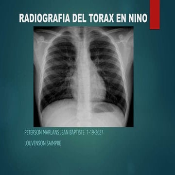 RADIOGRAFIA DEL TORAX EN NINO.pptx