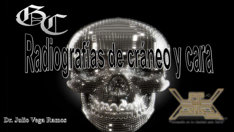 ¿Cómo se llama una radiografía de la cabeza?