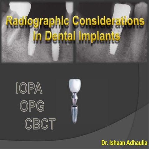 Radiographic considerations in dental implants