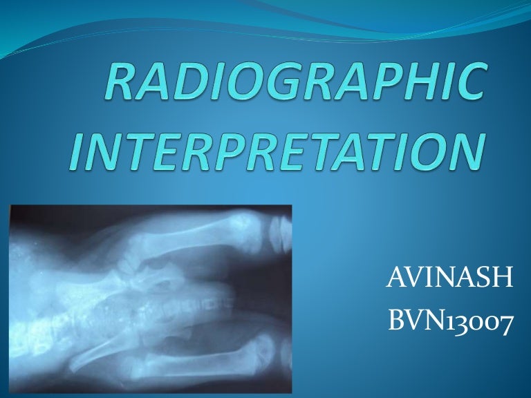 Radiographic interpretation