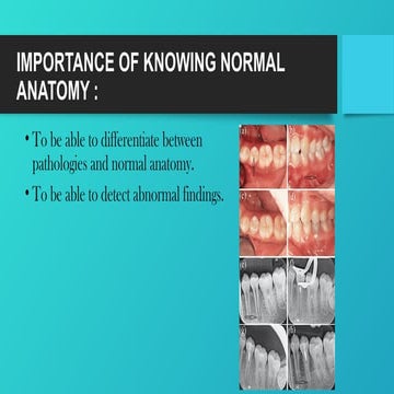Chapter 27:Normal Anatomy: Intraoral Images | PPTX