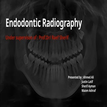 radiographs used in endo part 1 ppt.pptx