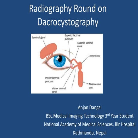 Radiography round on dacrocystography