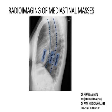 RADIOIMAGING IN MEDIASTINAL MASSES YN.pptx