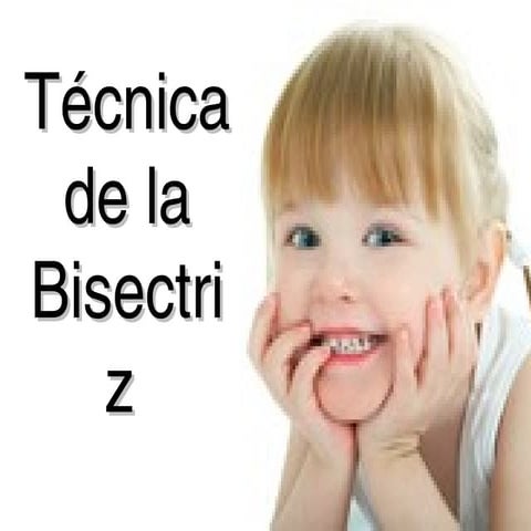 Tecnica de la bisectriz