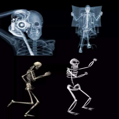 kelainan tulang.pptx