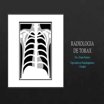 RADIOLOGIA DE TORAXmmmmmmmmmmmmmmmmmmmmmmmmmmmmmmmmmmm