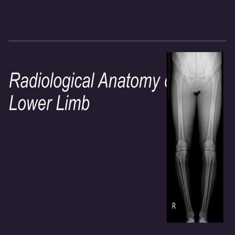 Radiological anatomy of lower limb