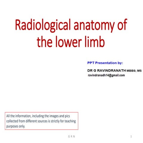 Radiological anatomy of the lower limb r