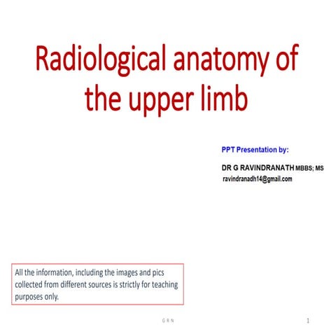 Radiological anatomy of the upper limb r