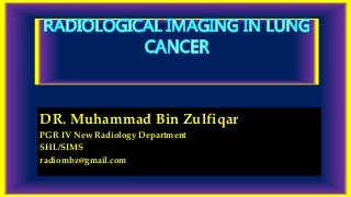 'lung cancer' on SlideShare