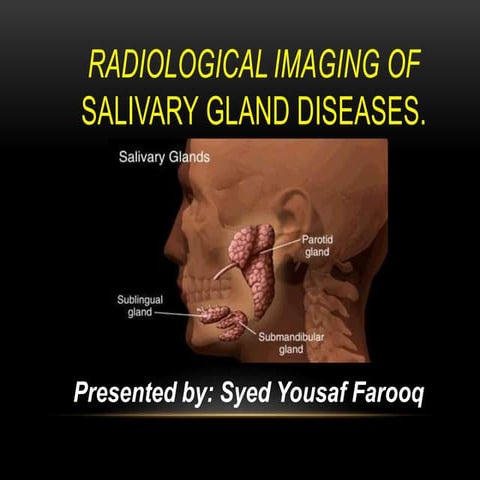 Radiological imaging of salivary gland diseases.