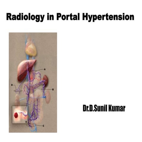Radiology in portal hypertension