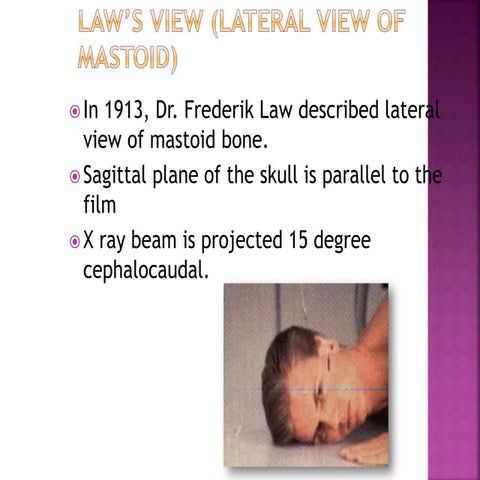 Radiology of ear - DR. ROHIT BHARDWAJ.pptx