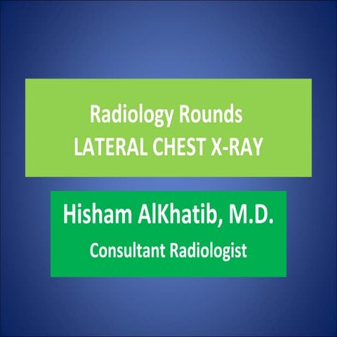 Radiology Rounds Basic Approach to Chest X-Ray , Lateral Chest | PPT