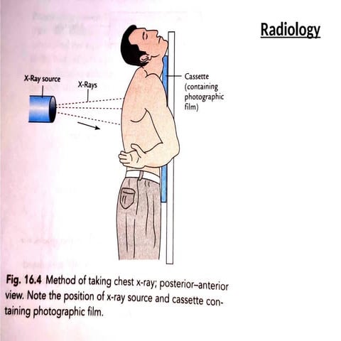 Comprehensive Radiology and Surface Anatomy of Upper and Lower Limbs | PPTX
