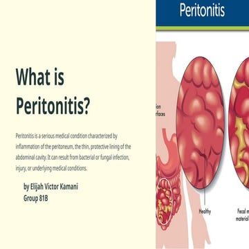 GASTROINTESTINAL PERFORATION & PERITONITIS.pptx